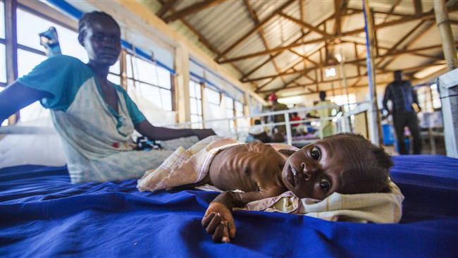UNICEF Solicit Funding To Support Malnourish Children in Sudan