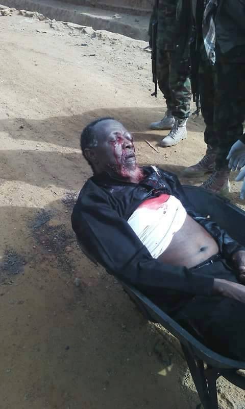EXCLUSIVE: Sheikh Zakzaky Blinded In One Eye, DSS Sources Say — SaharaReporters